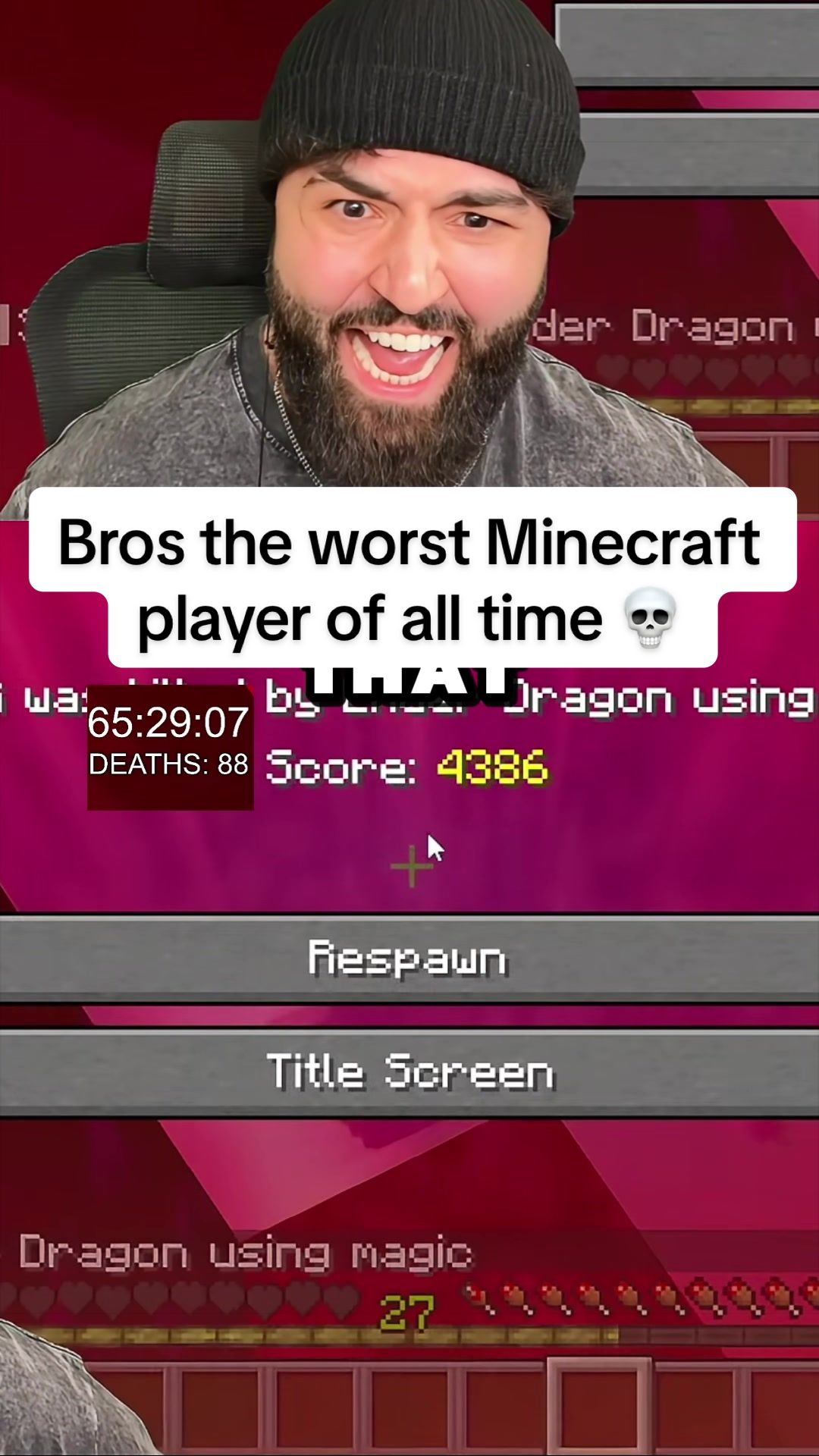 @Sxzxr