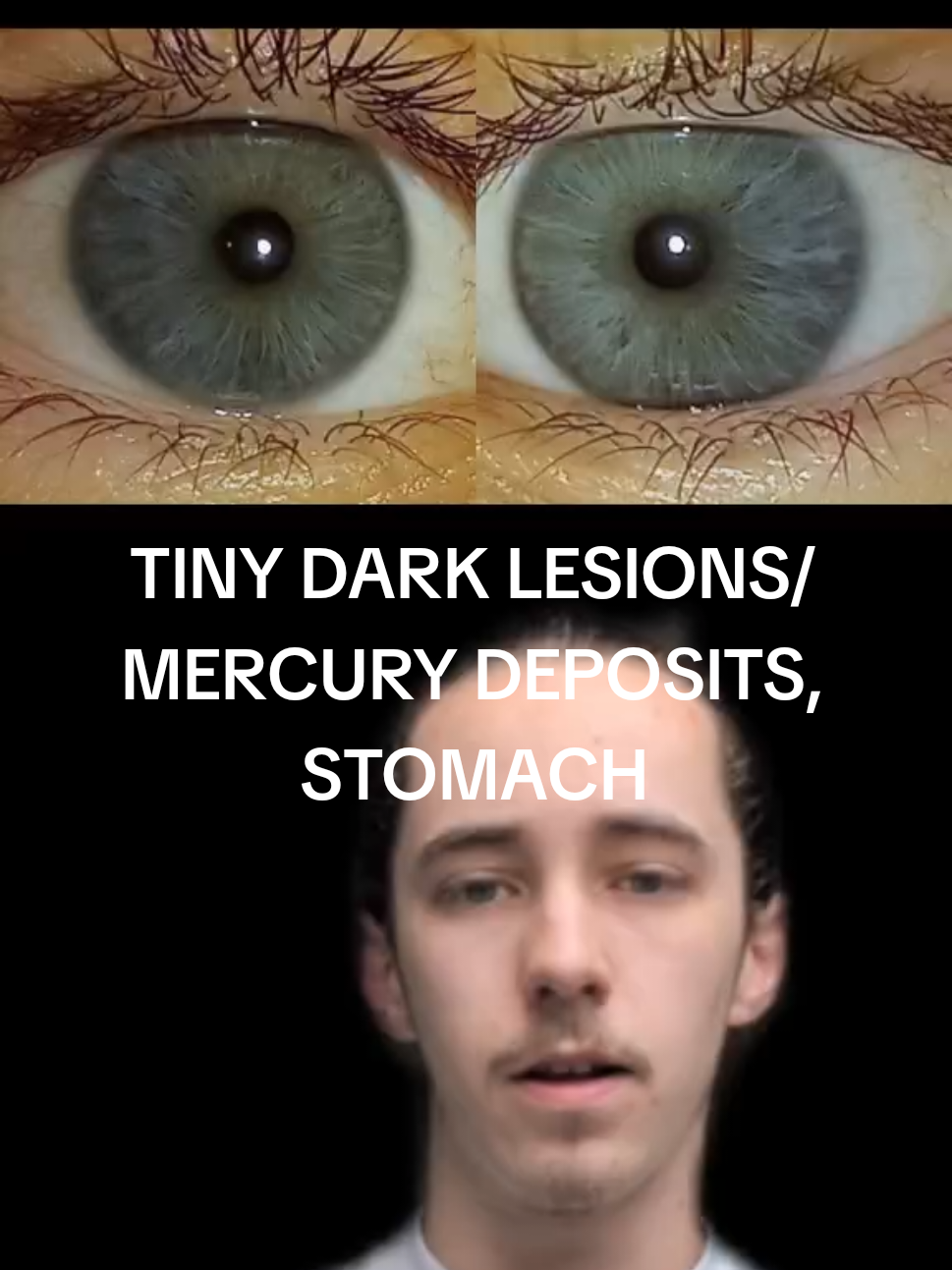 @Oliver | Aajonus' Iridology 👀