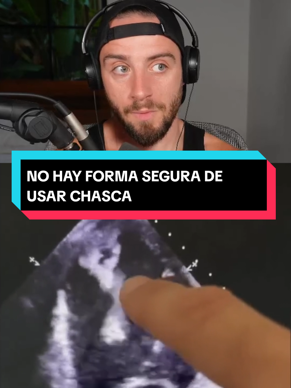 @JoelusFitness