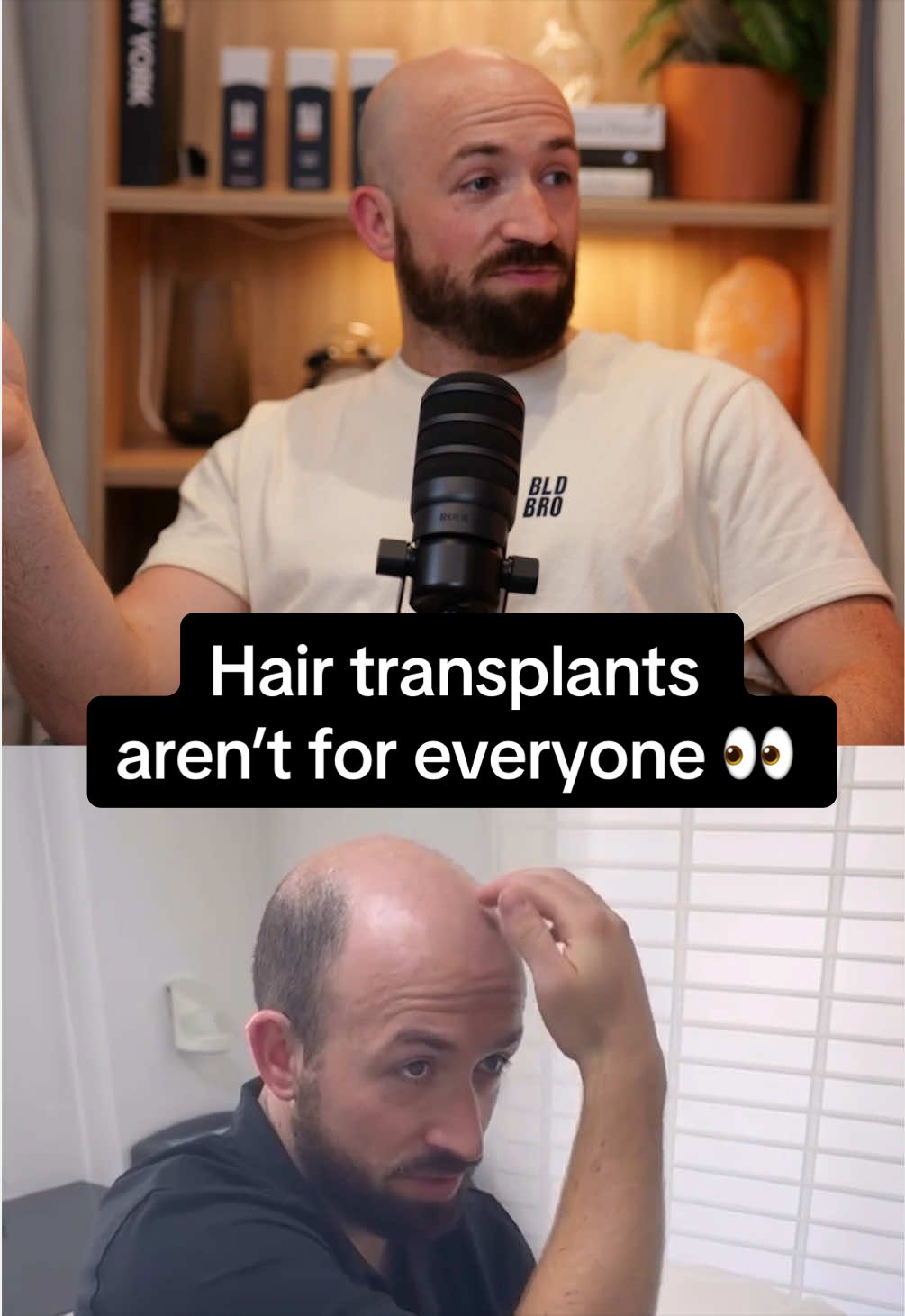 @BLDBRO