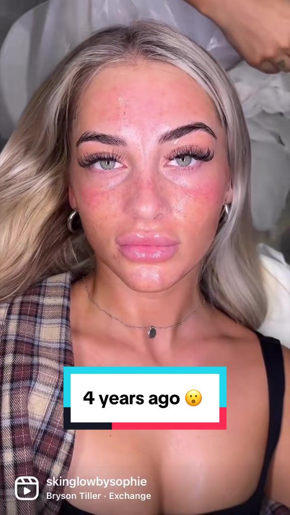 @Skinglowbysophie