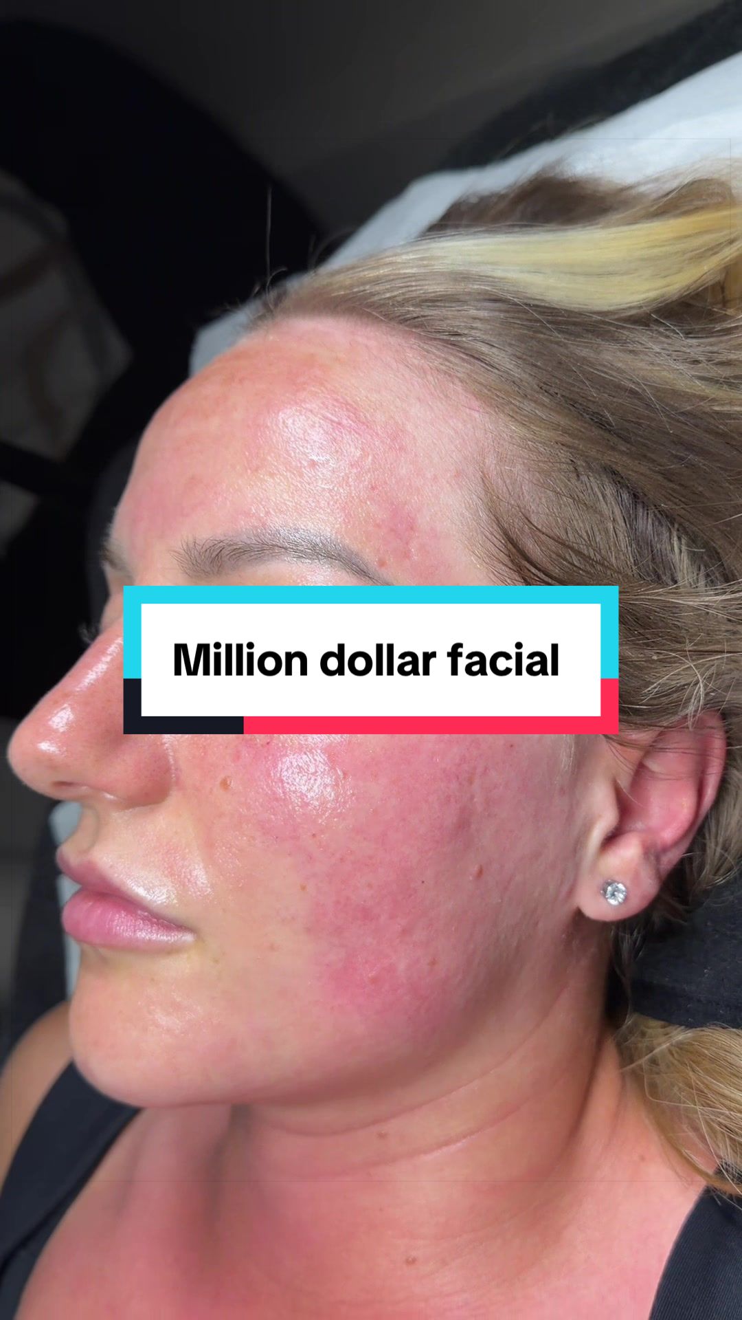 @Skinglowbysophie
