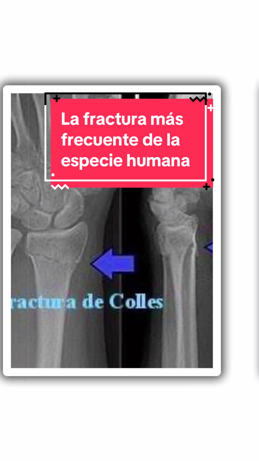 @Ha dicho un enfermero..