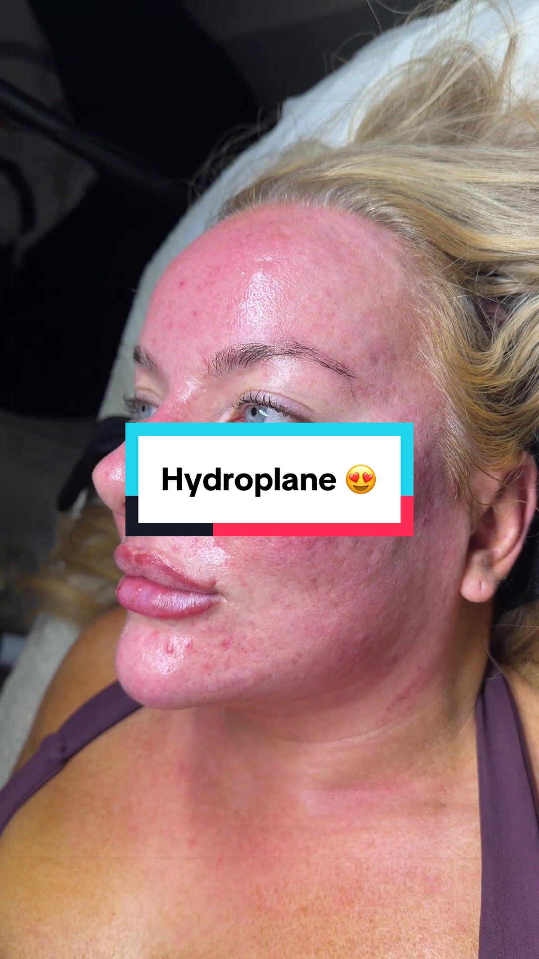 @Skinglowbysophie
