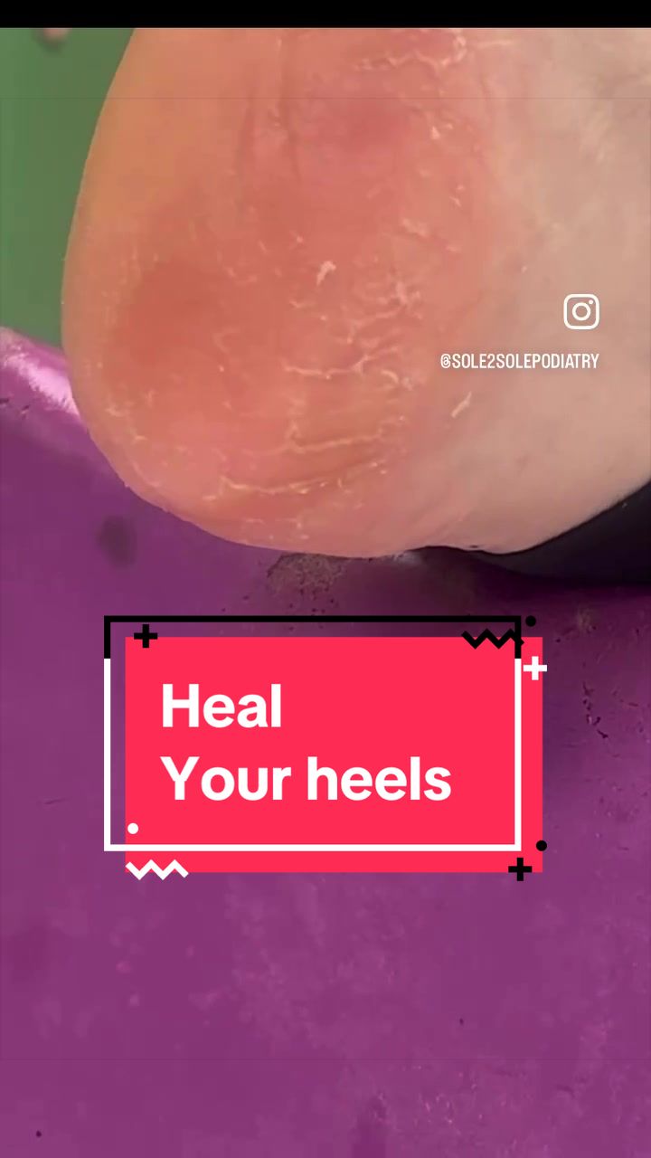 @Sole2Solepod
