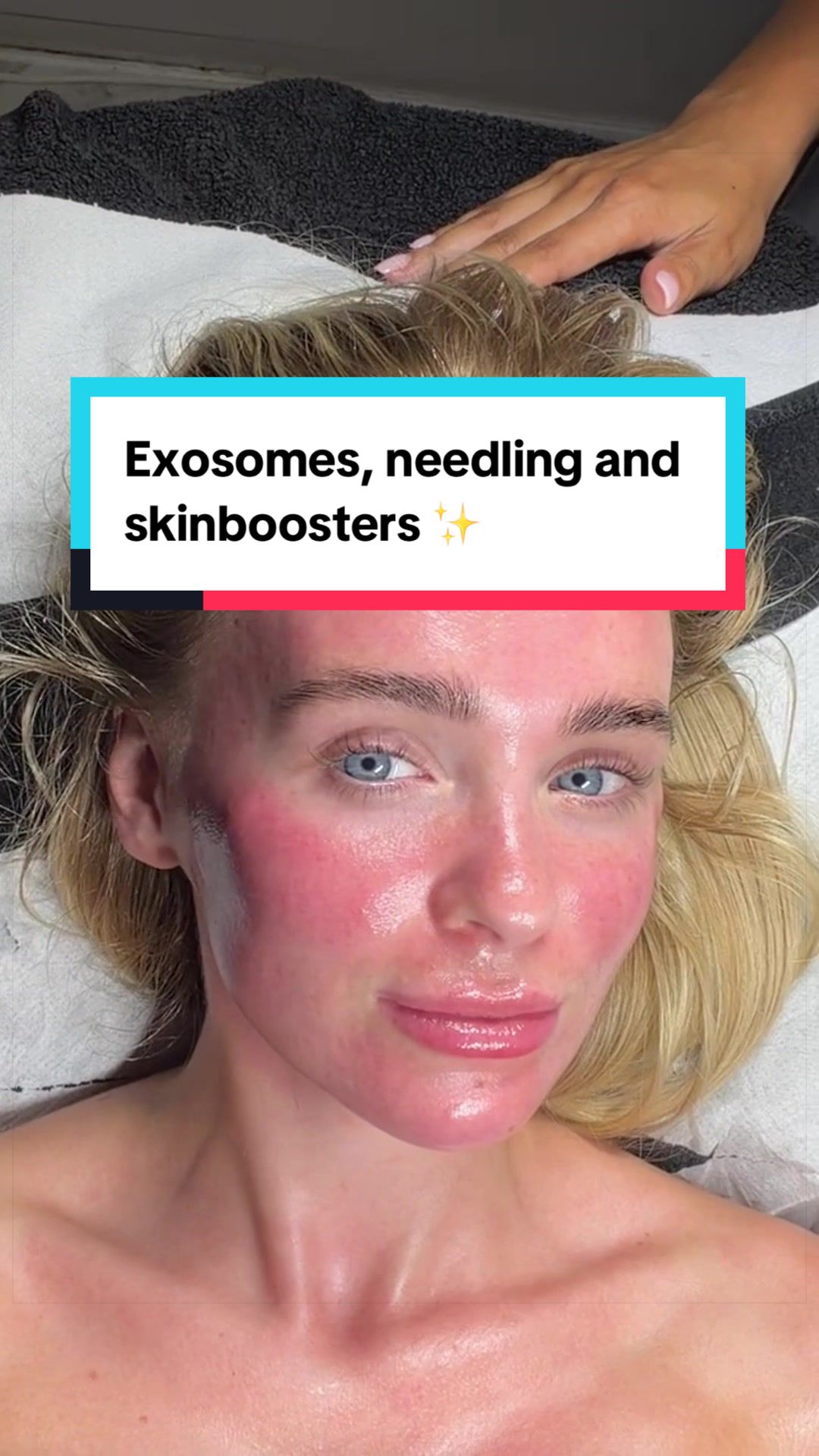 @Skinglowbysophie