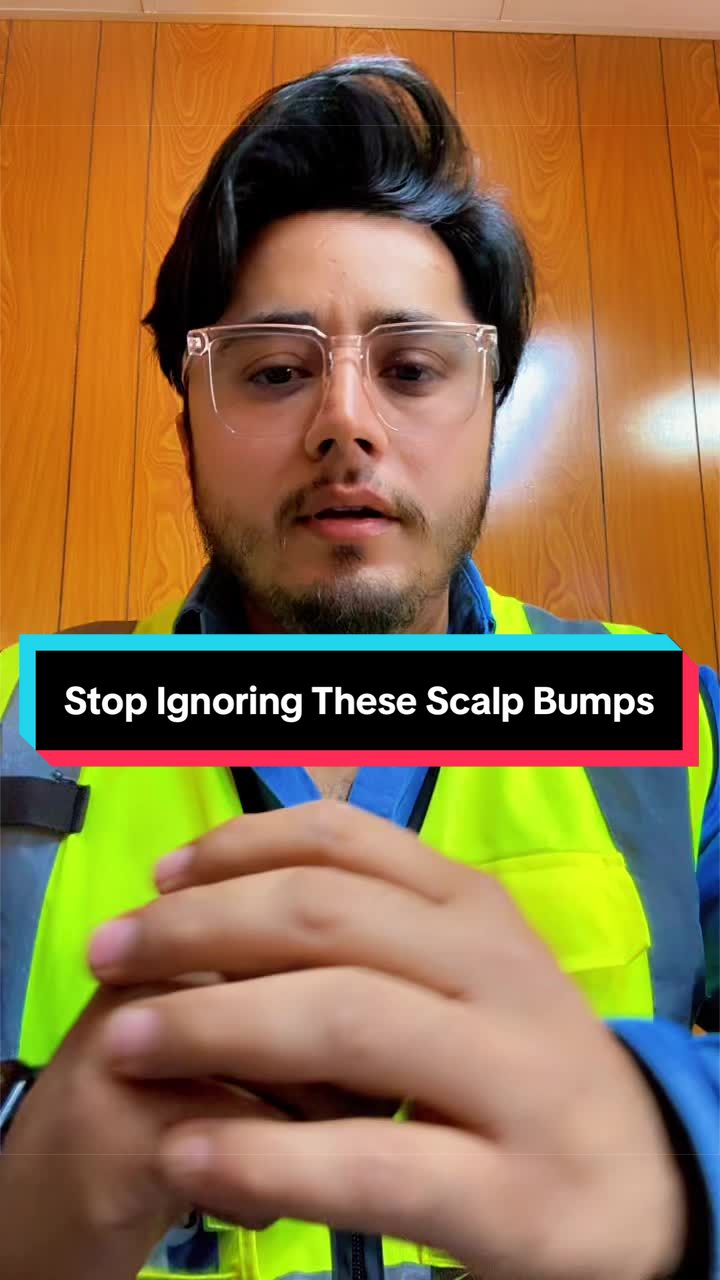 @ARK