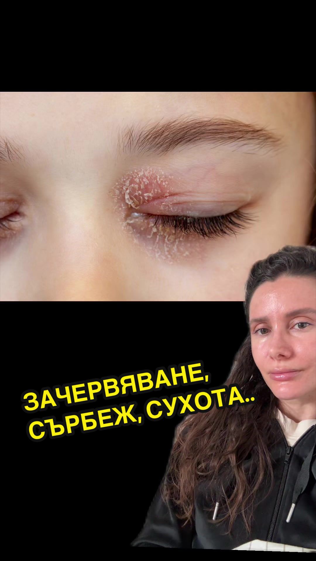 @💉👩🏻&zwj;⚕️ СкинТок Дерматолог