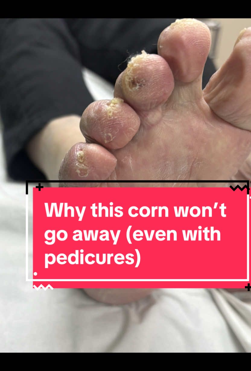 @Sole2Solepod