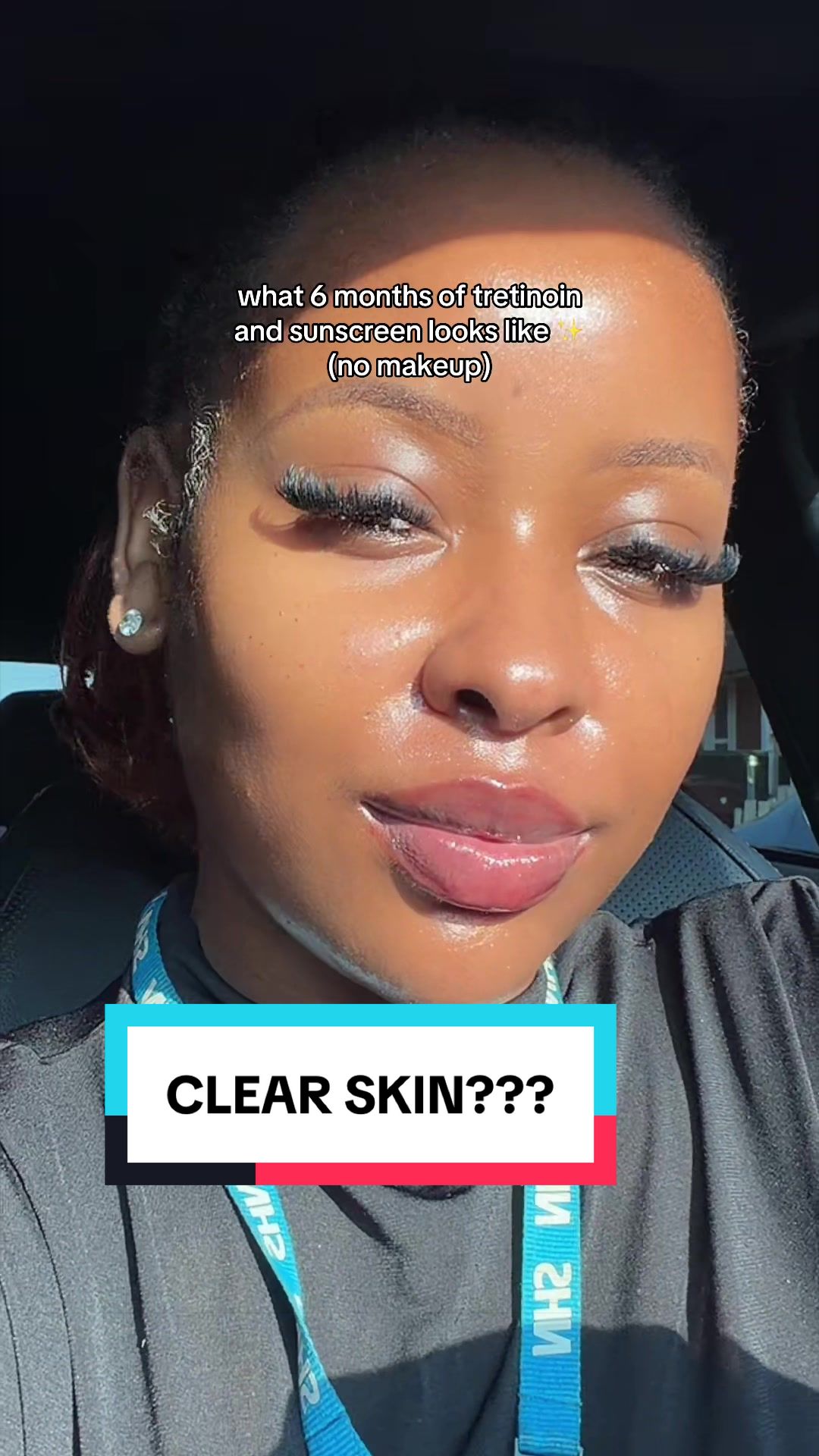@skincare | motherhood | life