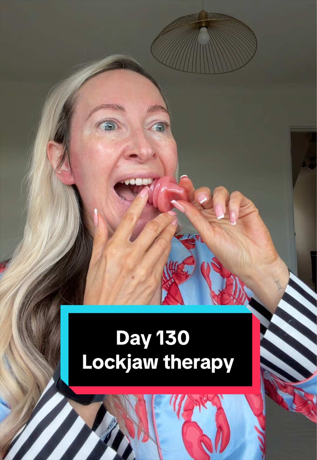 @Mylockjawlife