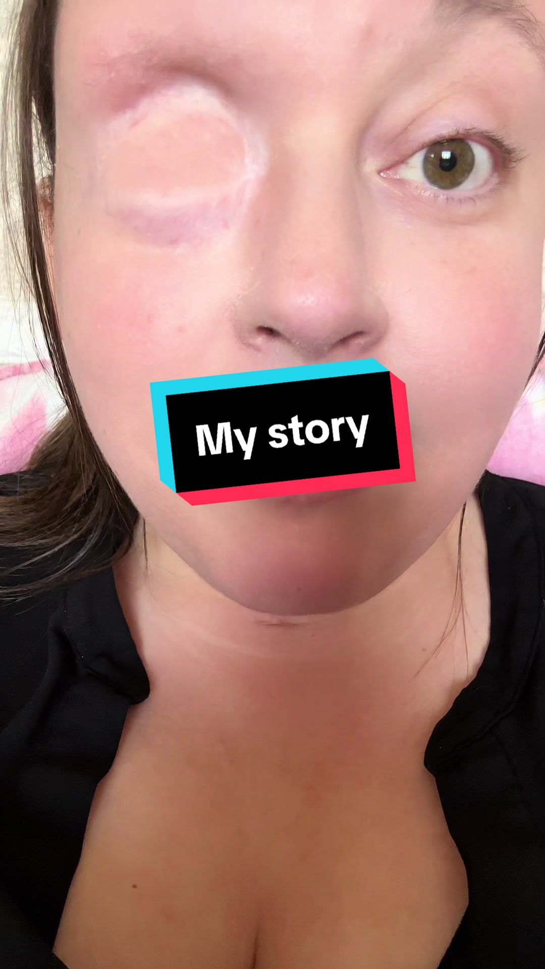 @eyeofthesarcoma