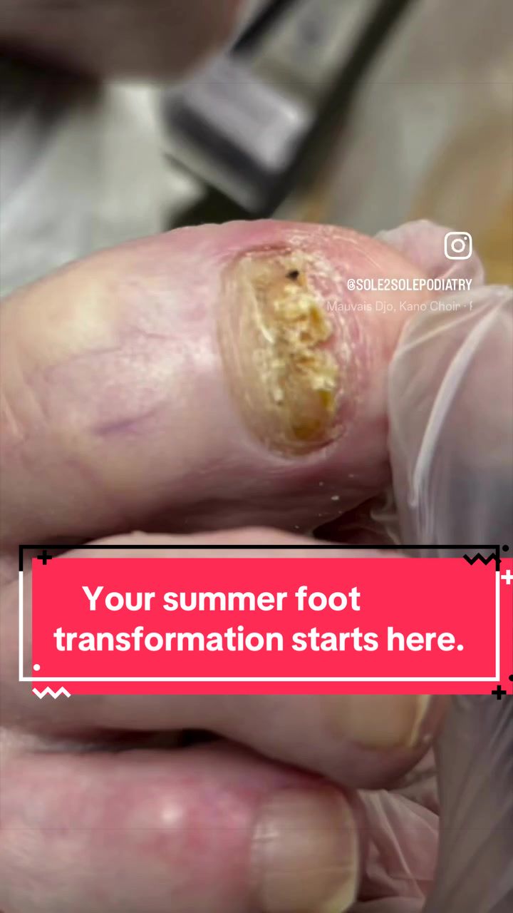 @Sole2Solepod