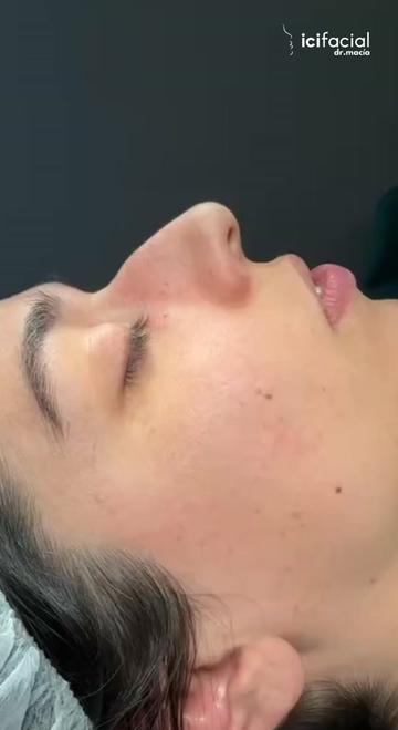 @Drmacia.icifacial