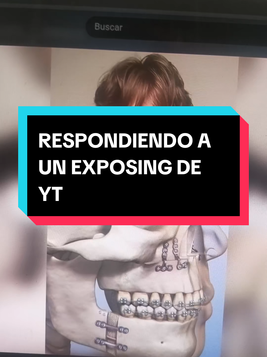 @RubénMaxxing2