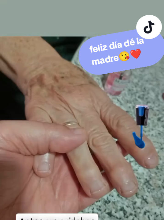 @TOÑI CANARIA