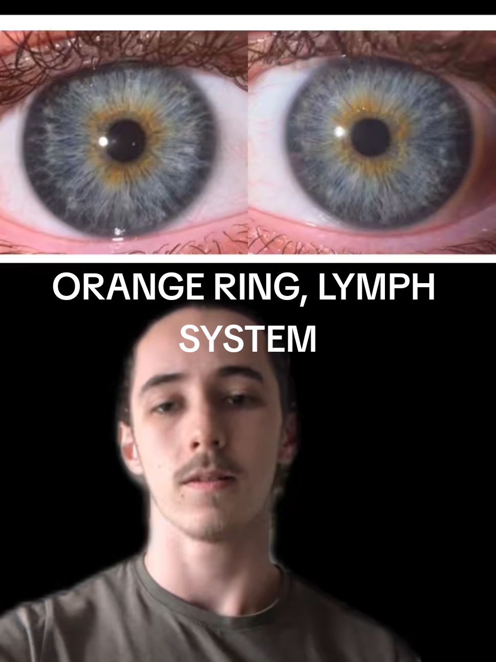@Oliver | Aajonus' Iridology 👀