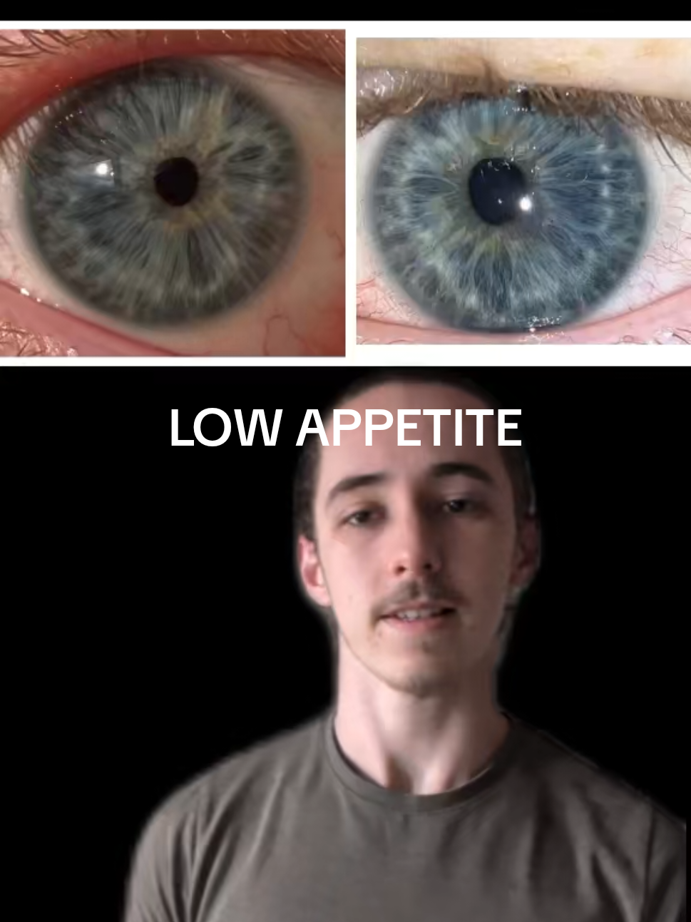 @Oliver | Aajonus' Iridology 👀