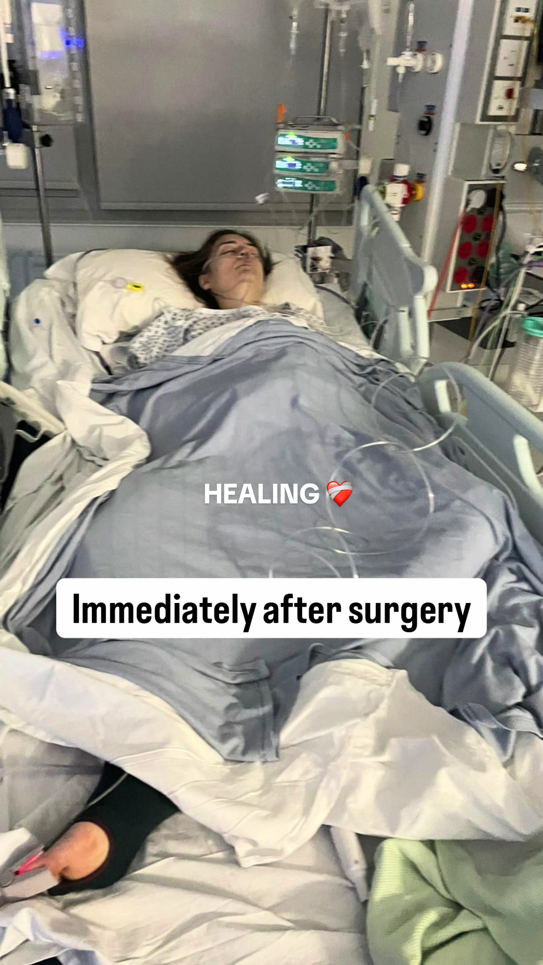 @Louise | Stoma & Crohns