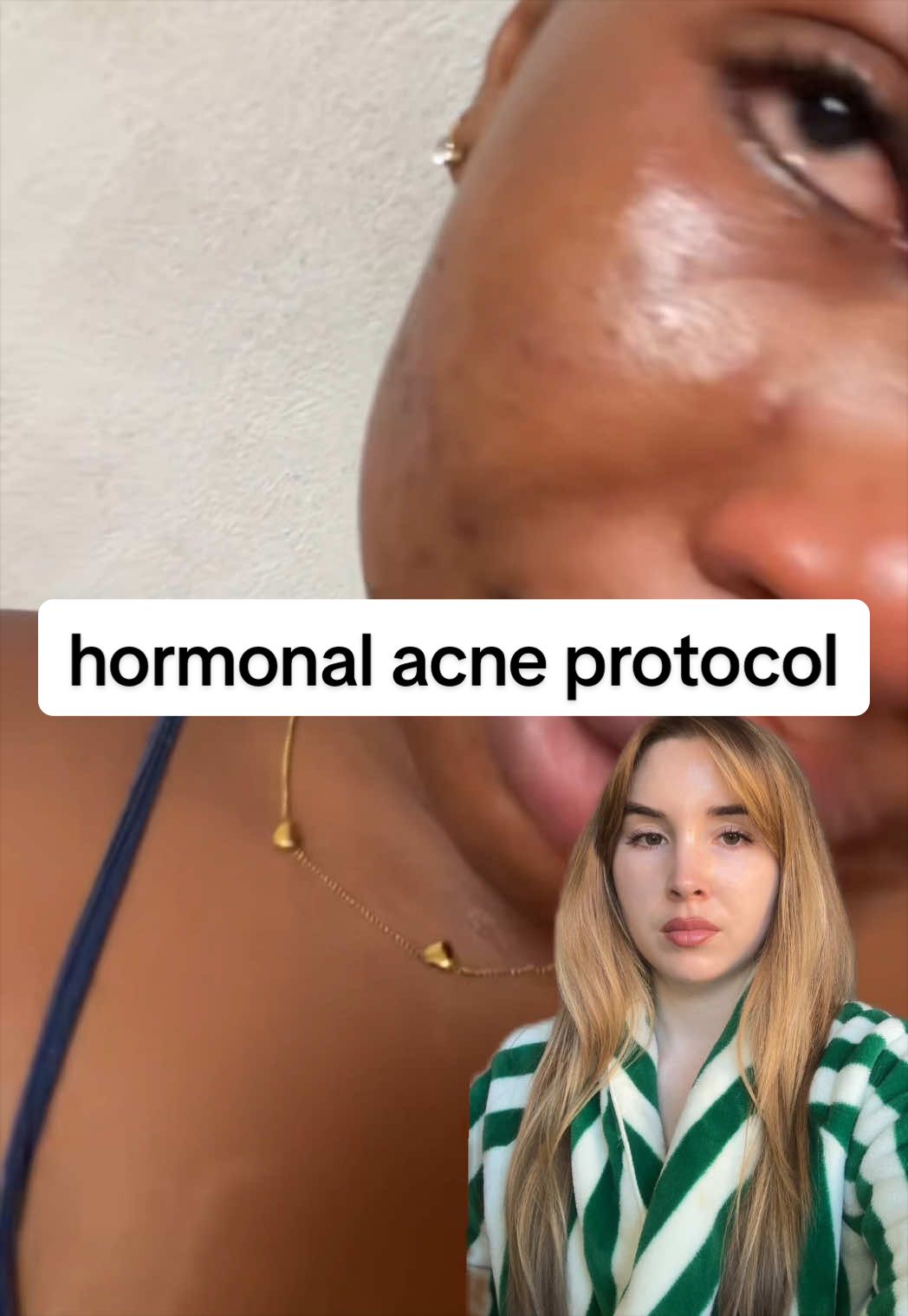 @Natalie O'Neill