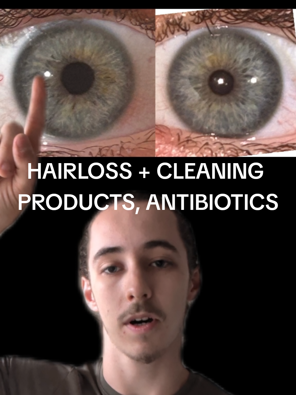 @Oliver | Aajonus' Iridology 👀