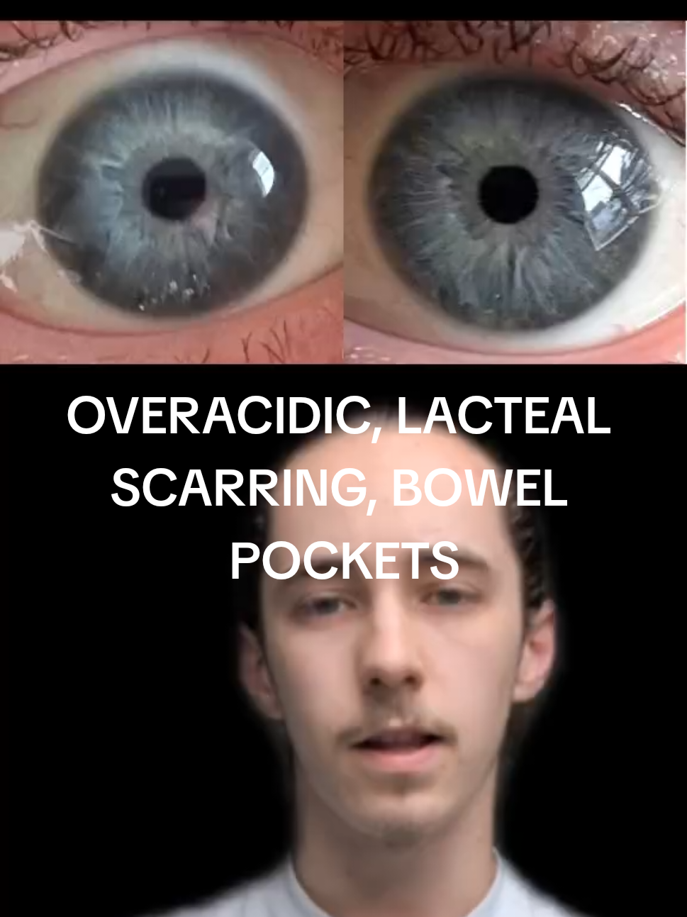 @Oliver | Aajonus' Iridology 👀
