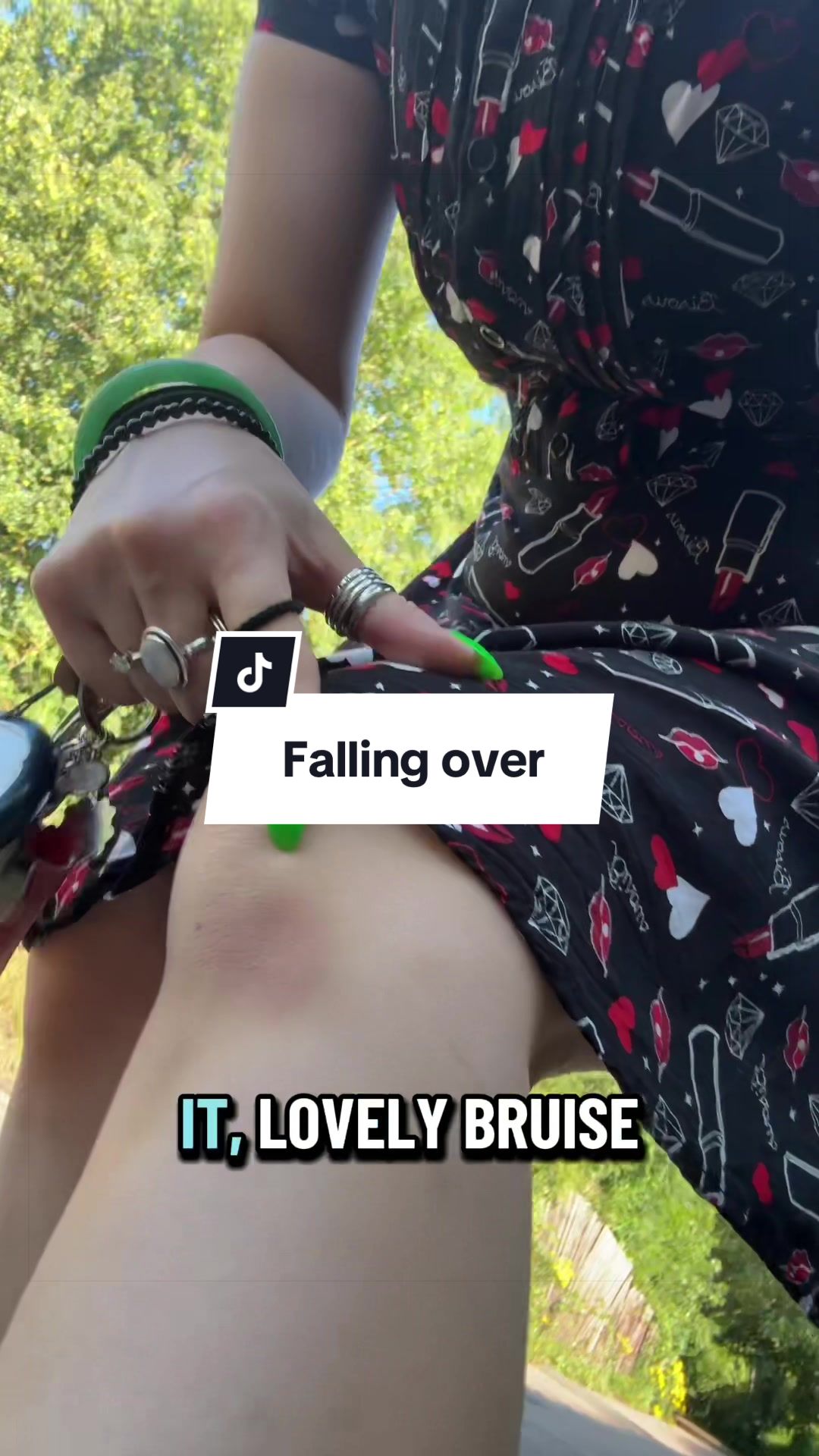@alt_audhd
