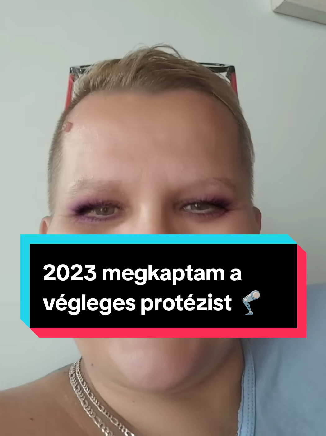 @🦿Évi élete🦿