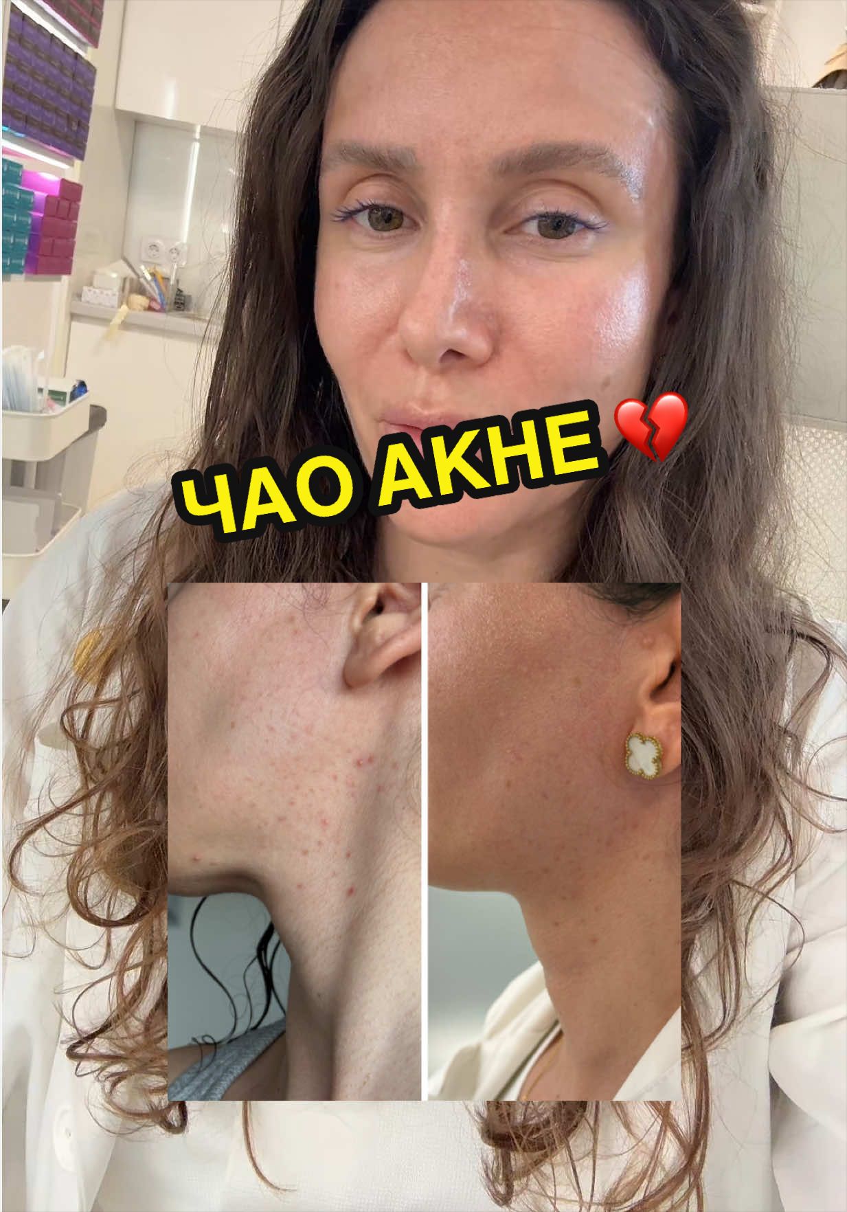 @💉👩🏻&zwj;⚕️ СкинТок Дерматолог