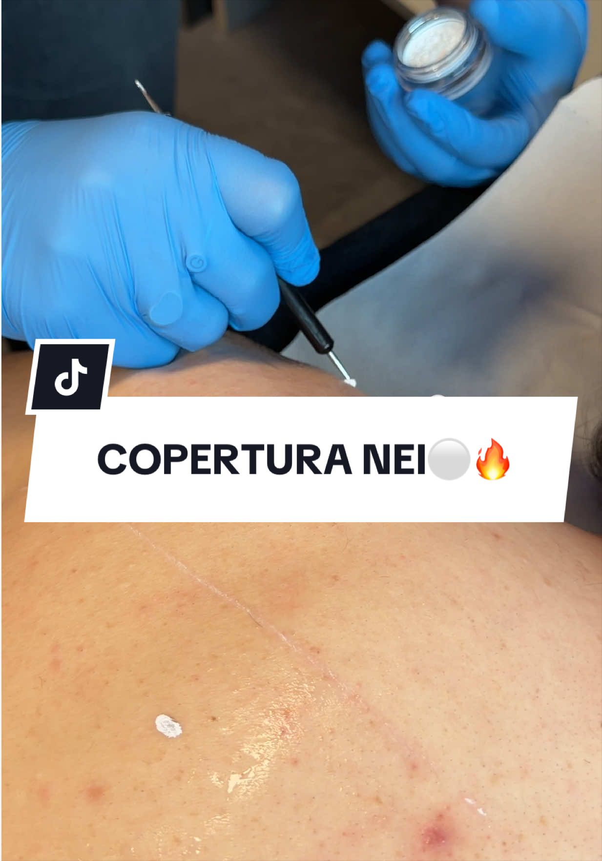 @epilambra