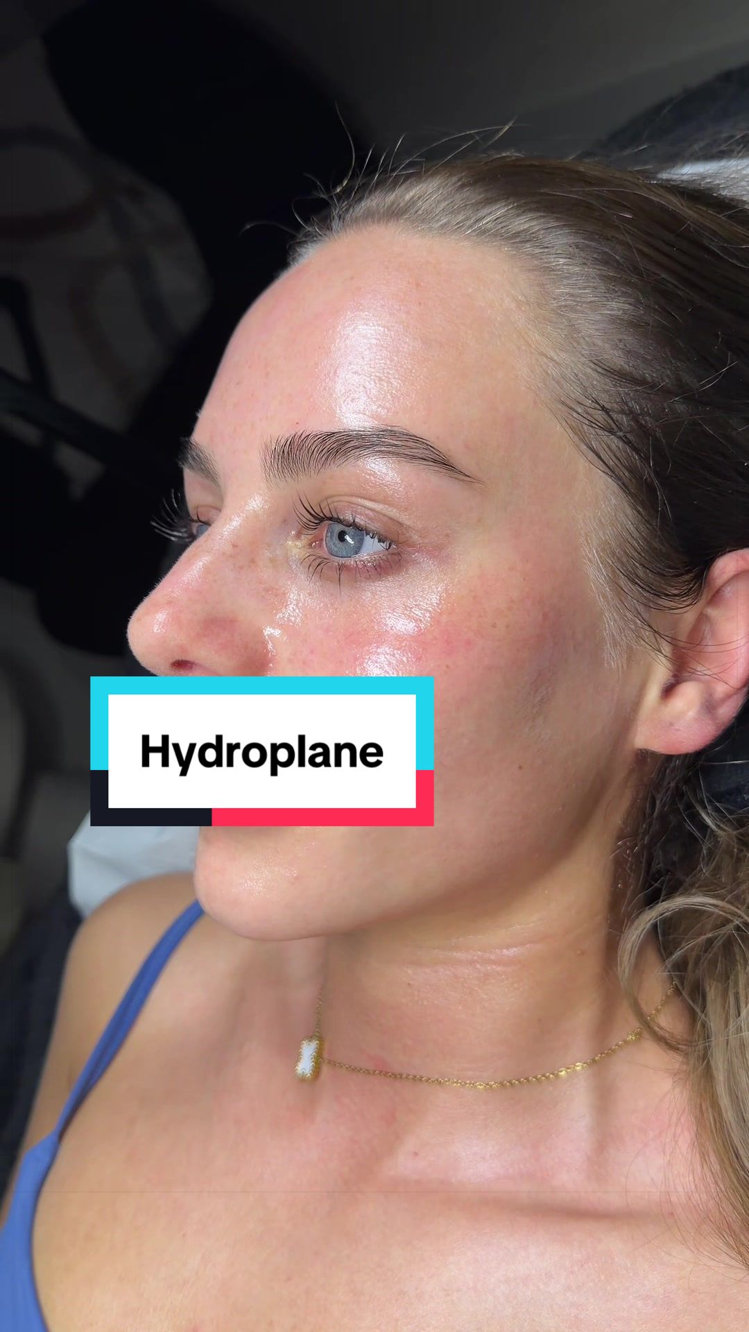 @Skinglowbysophie
