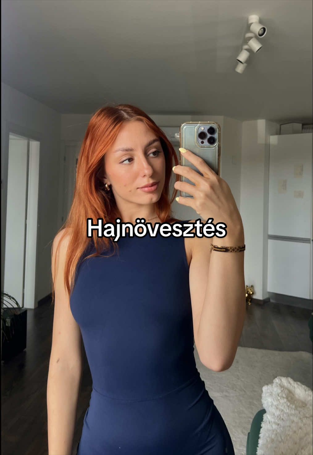 @Liliána Antal🪐