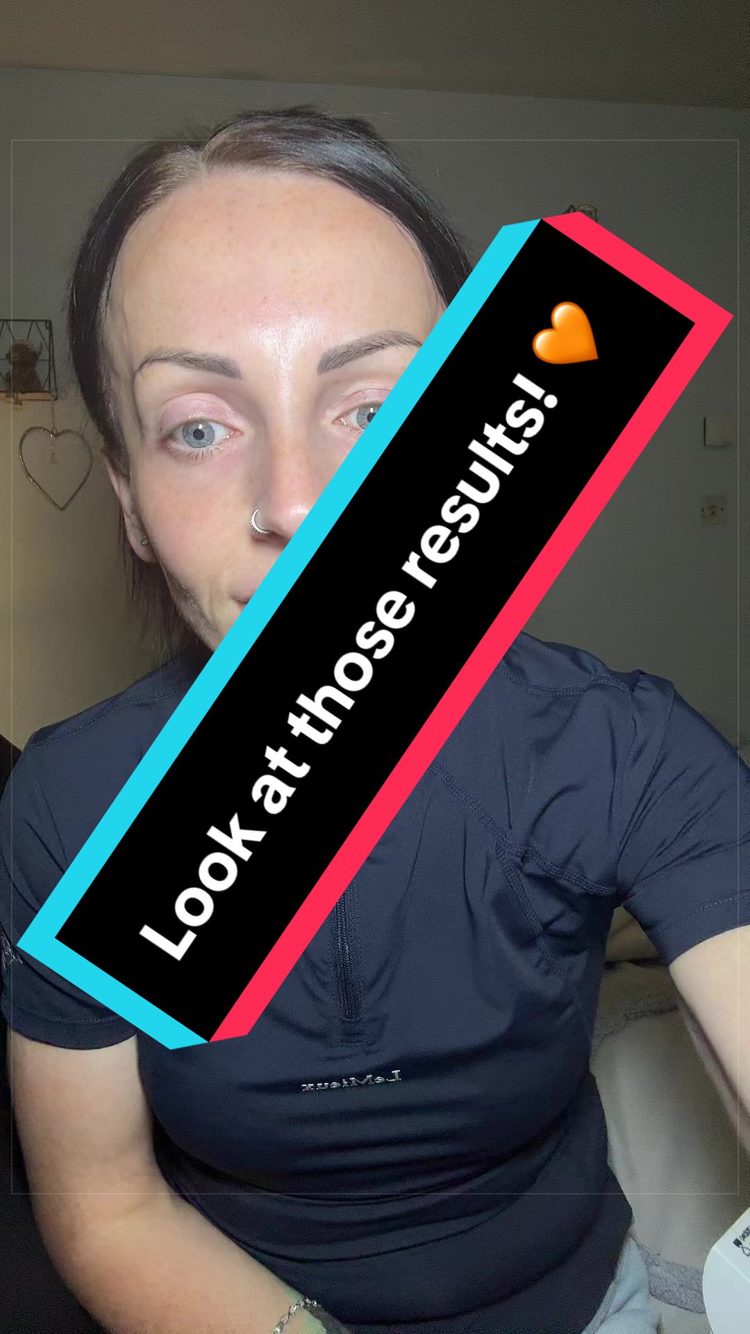 @Gemma | AuDHD| Nurse ๐