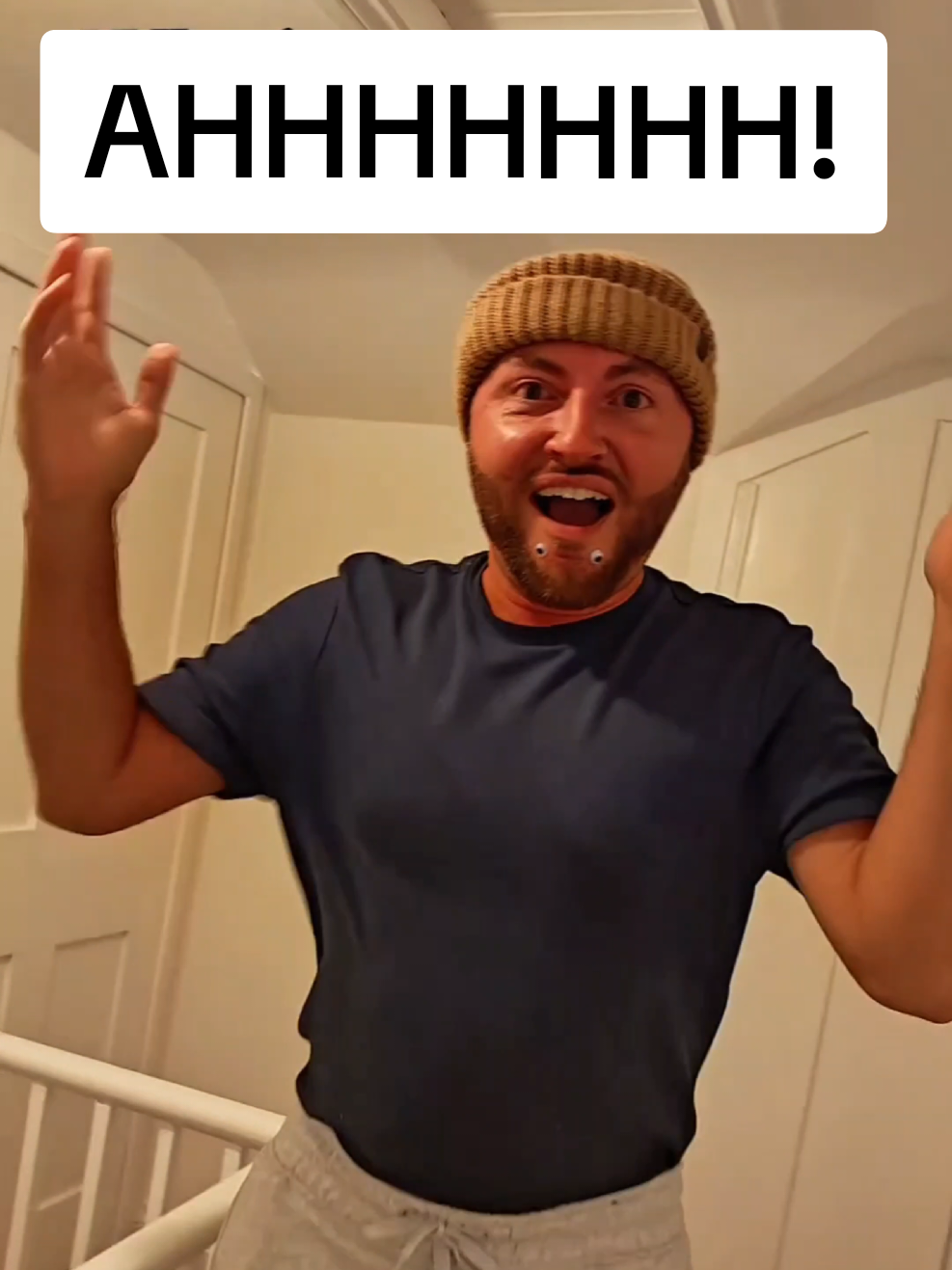 @Chinfaced