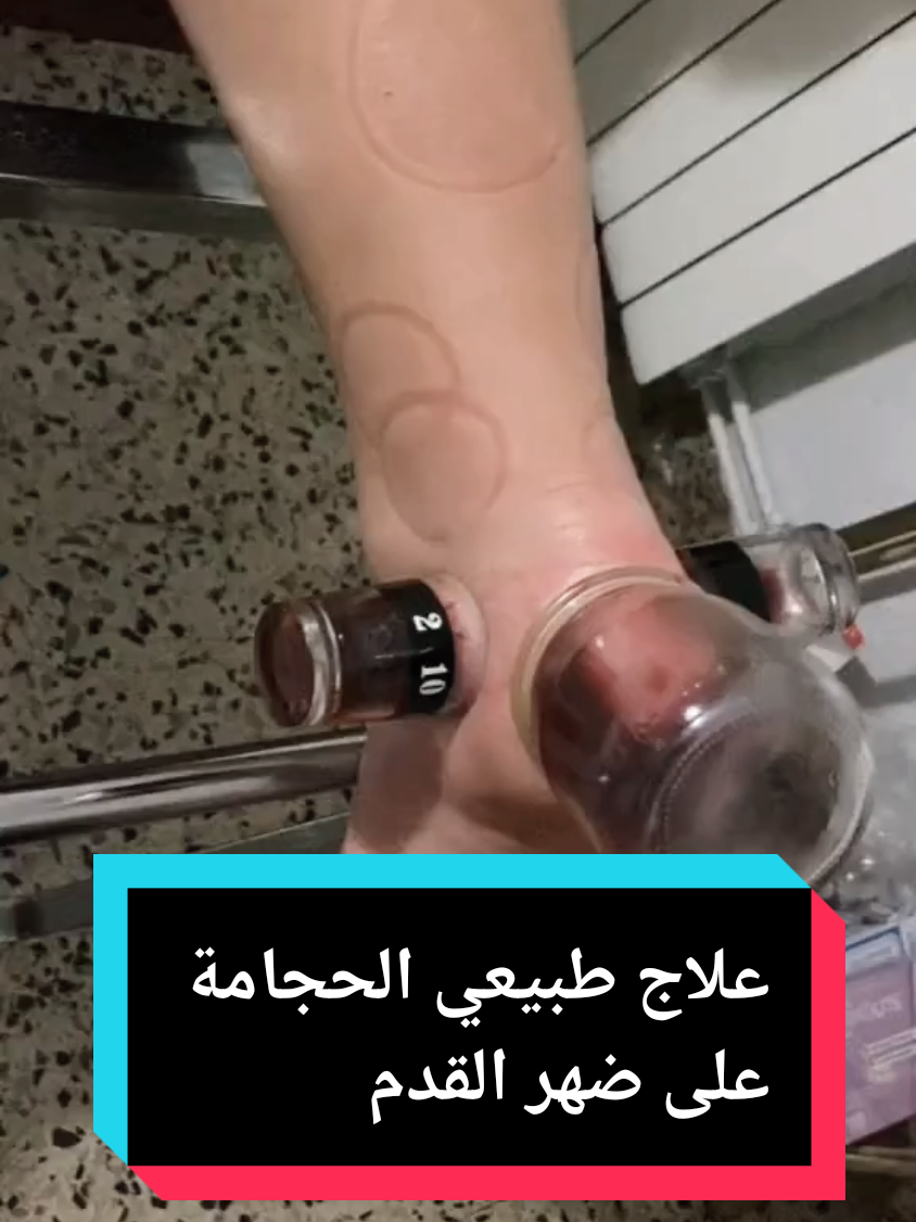 @مركز الأصيل للعناية الجسدية 2