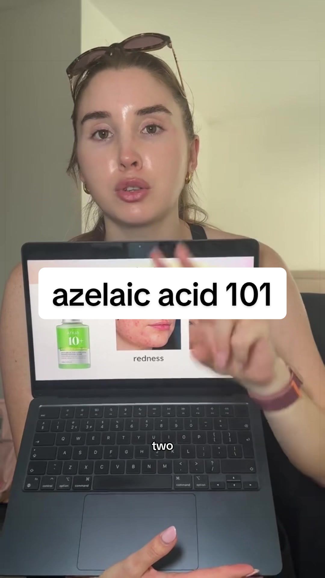 @Natalie O'Neill