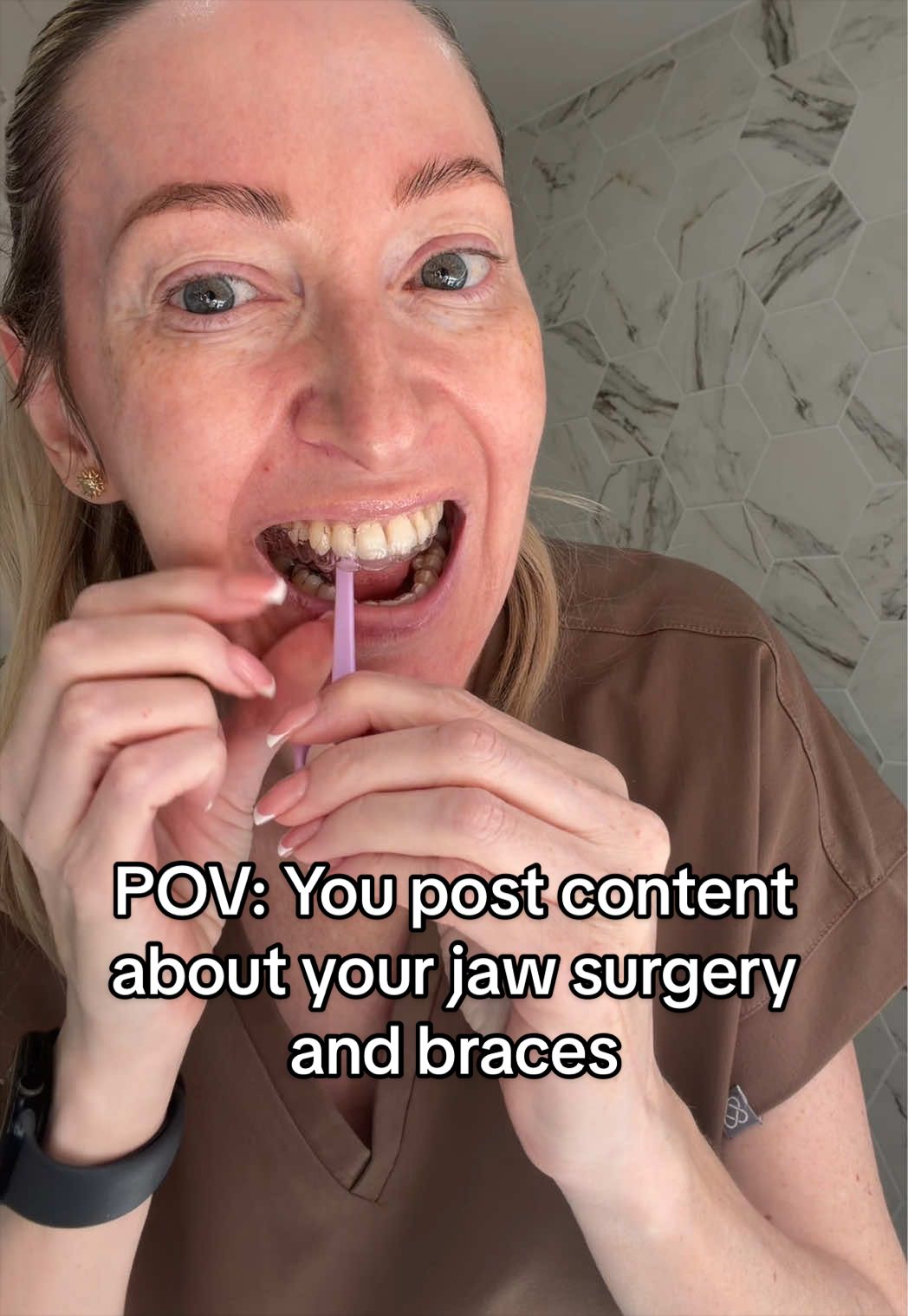 @Mylockjawlife