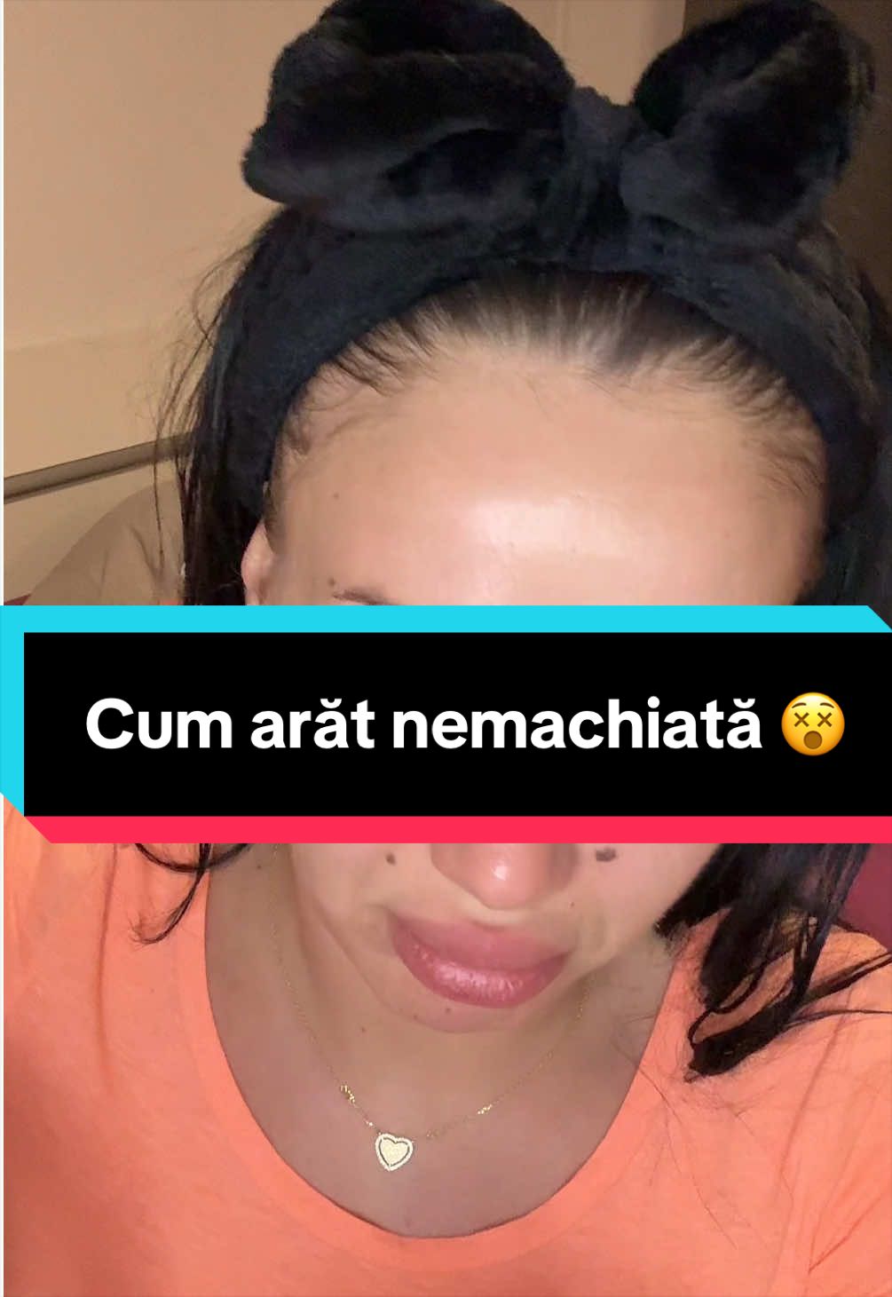 @🍓