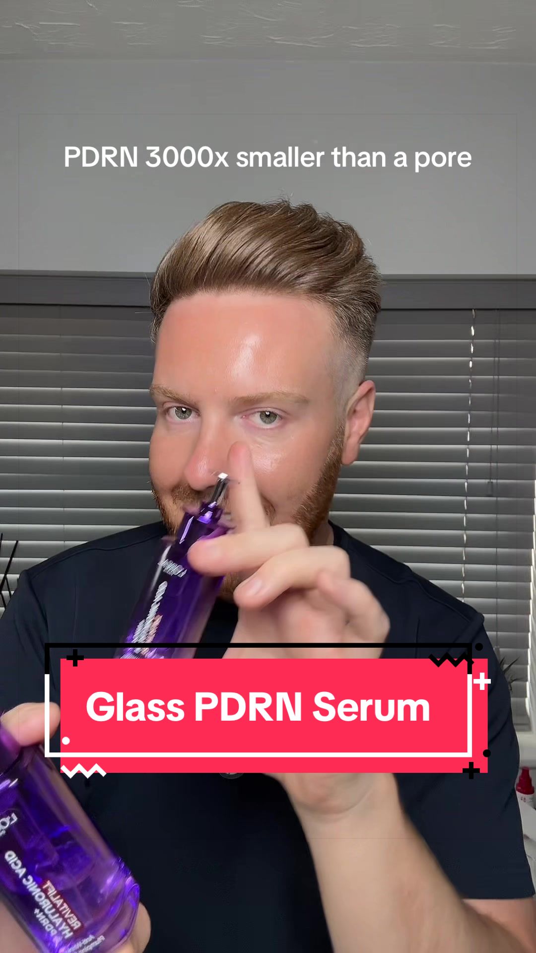 @Adam