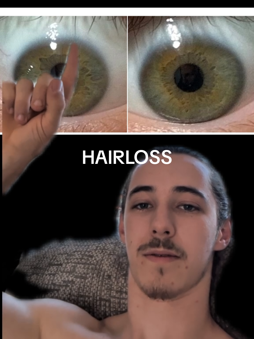 @Oliver | Aajonus' Iridology 👀