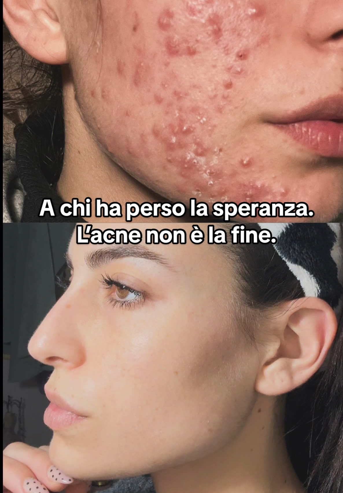 @Maartinz