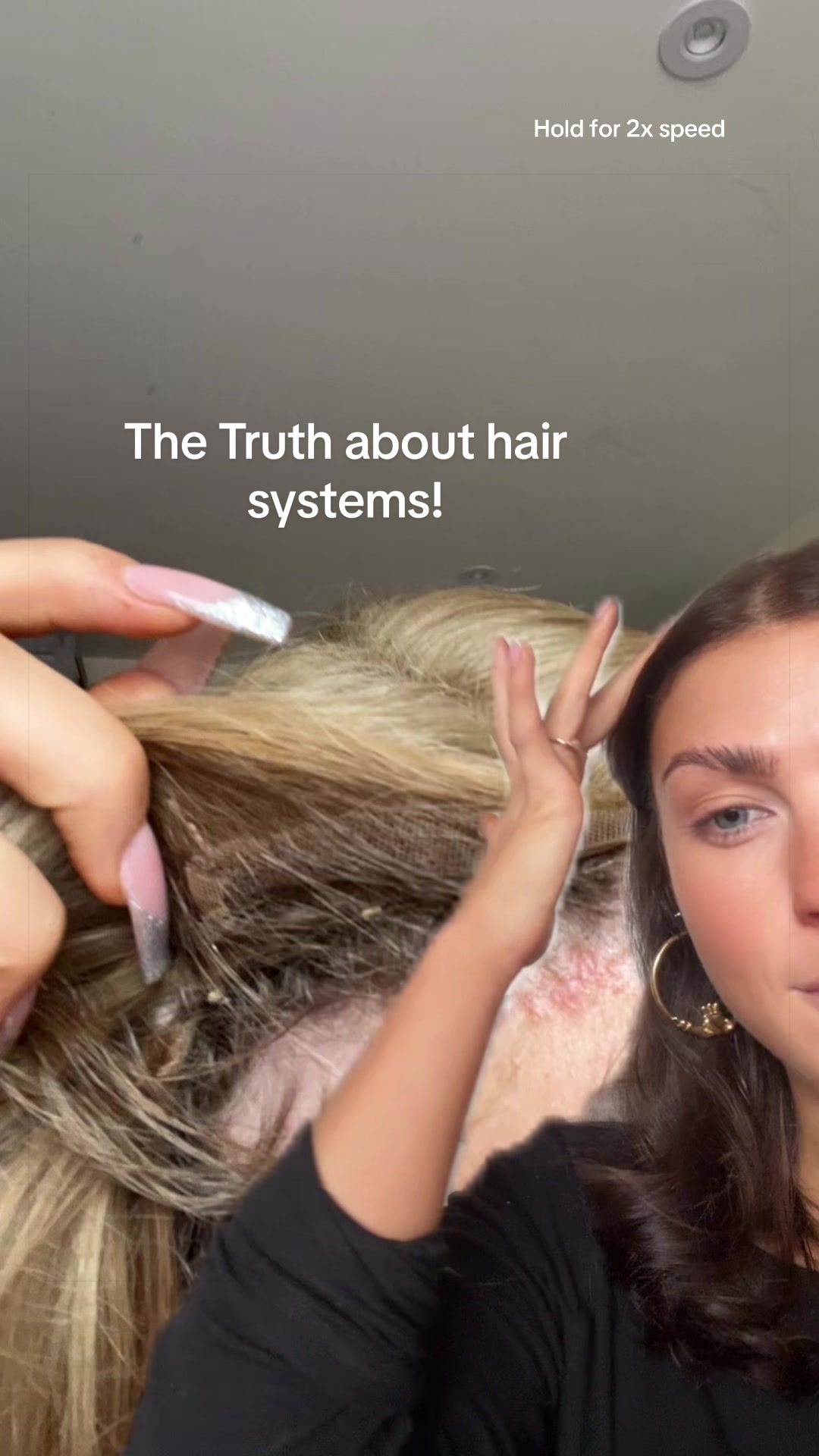 @Brooke💗Hair loss Journey
