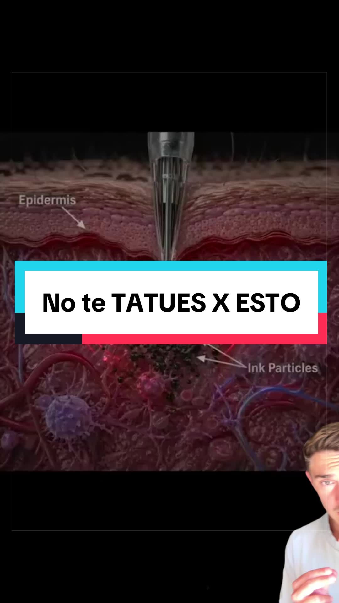 @DietAlvaro