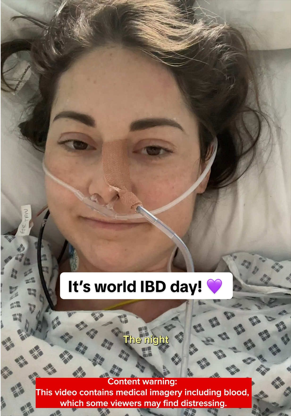 @Louise is getting better