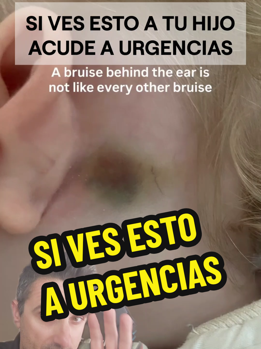 @Miguel ASSAL