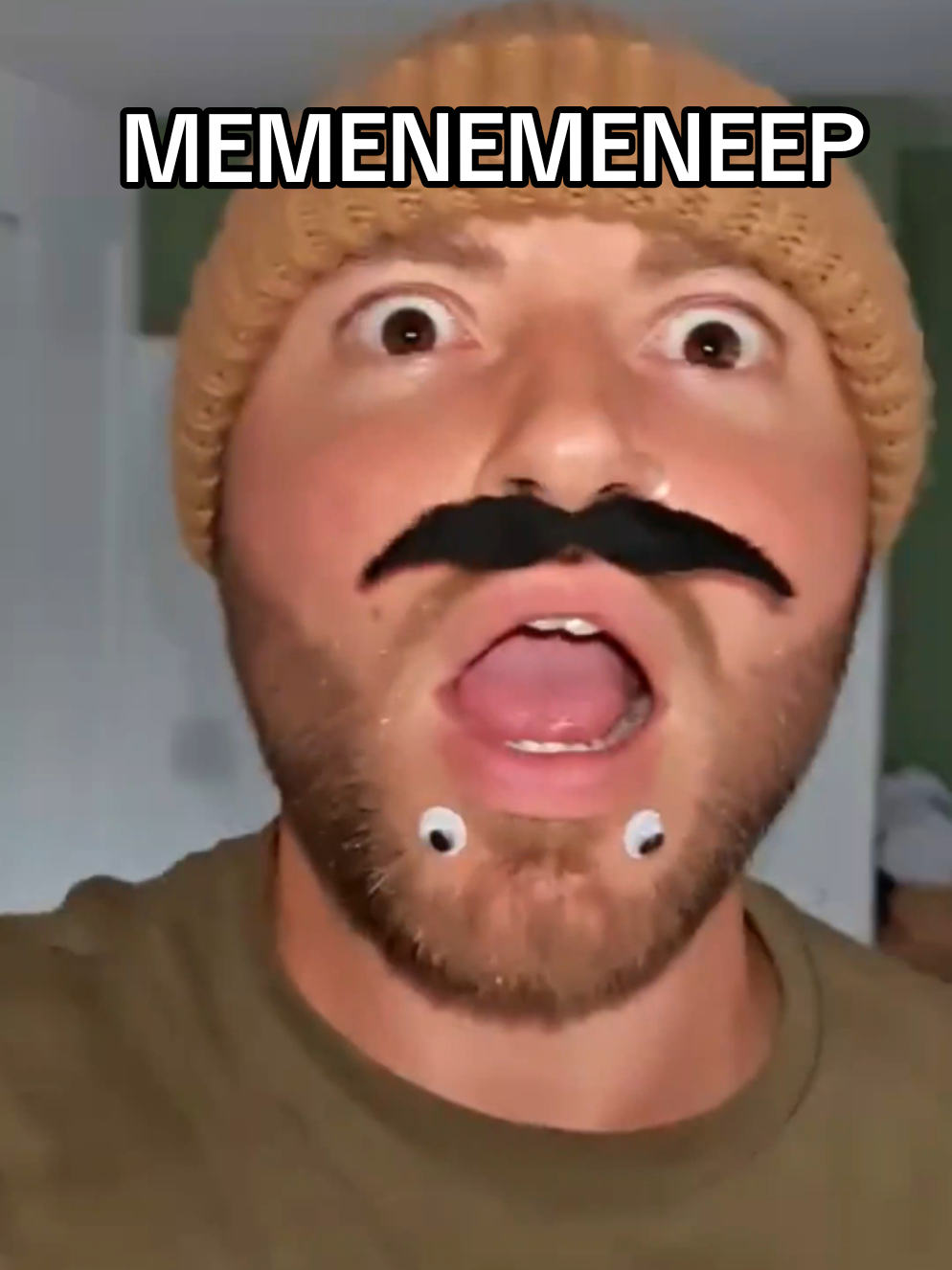 @Chinfaced