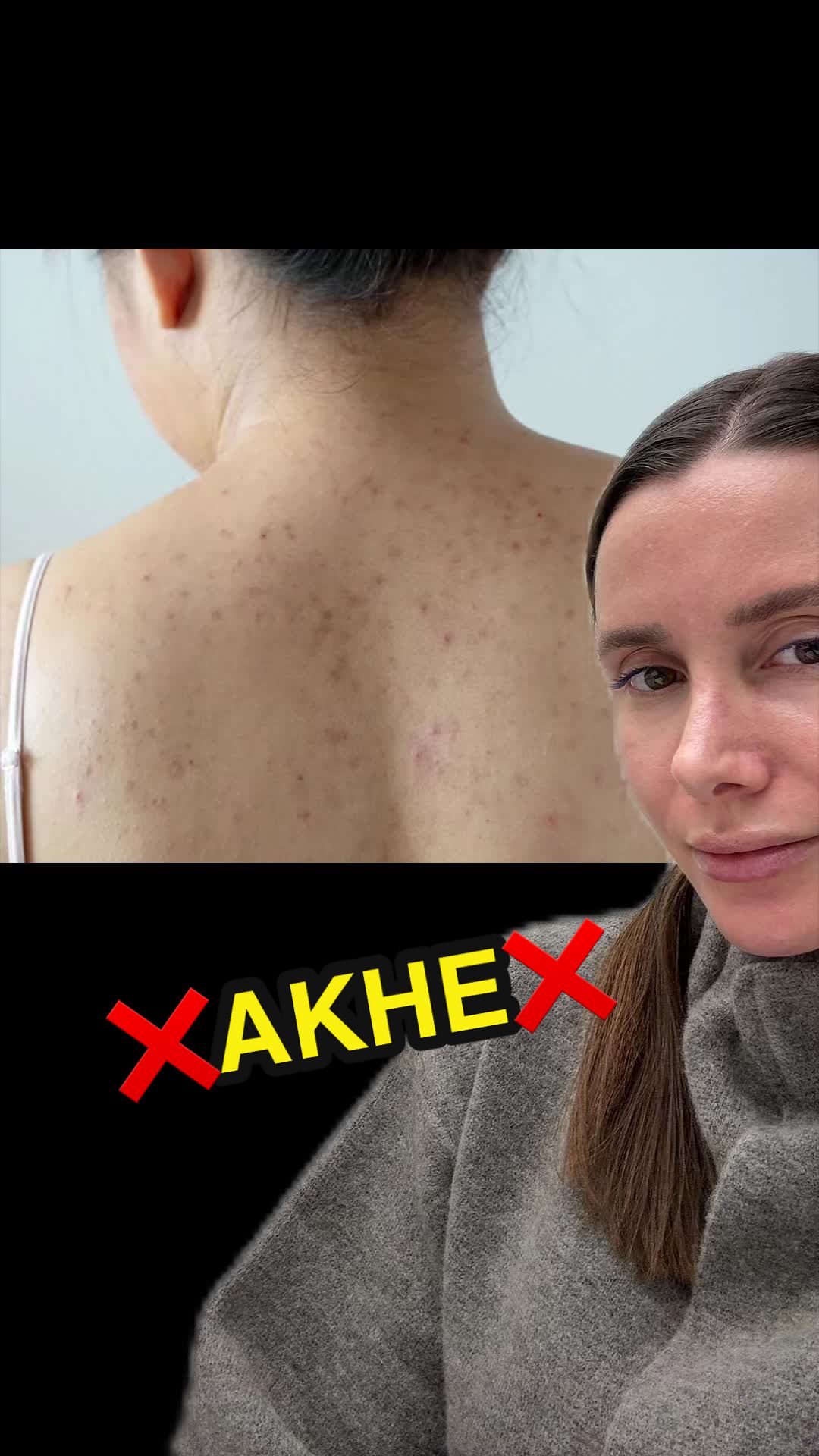 @💉👩🏻&zwj;⚕️ СкинТок Дерматолог