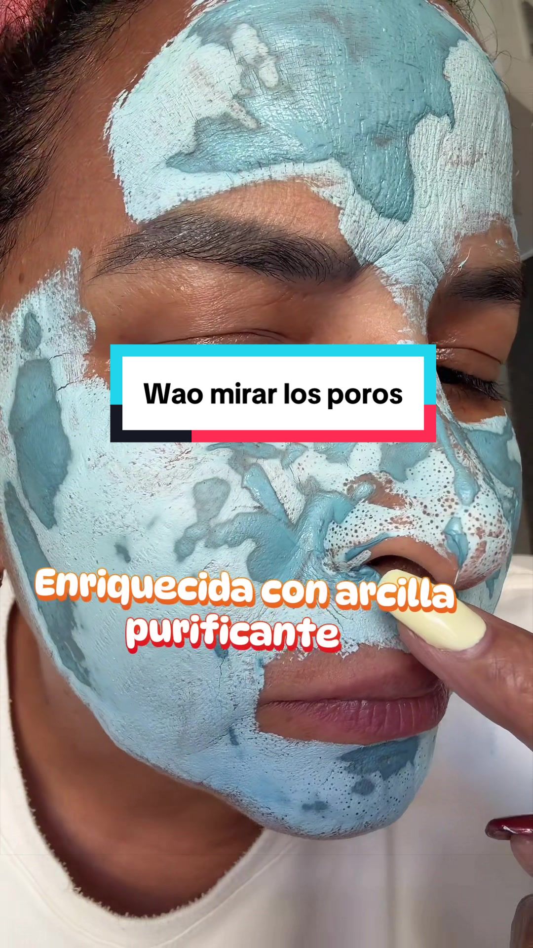 @Yake Crespo-UGC