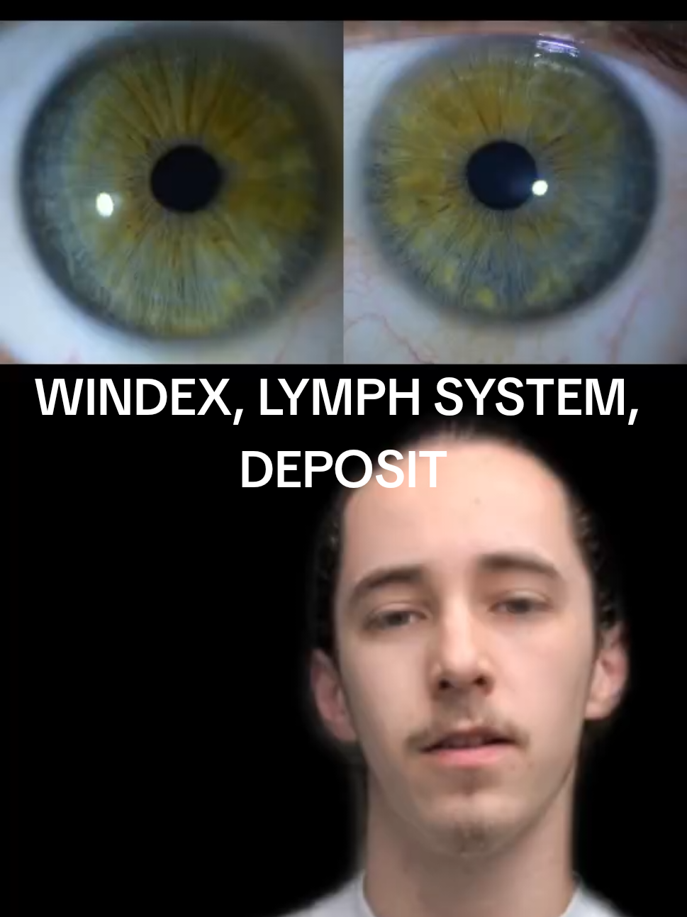 @Oliver | Aajonus' Iridology 👀