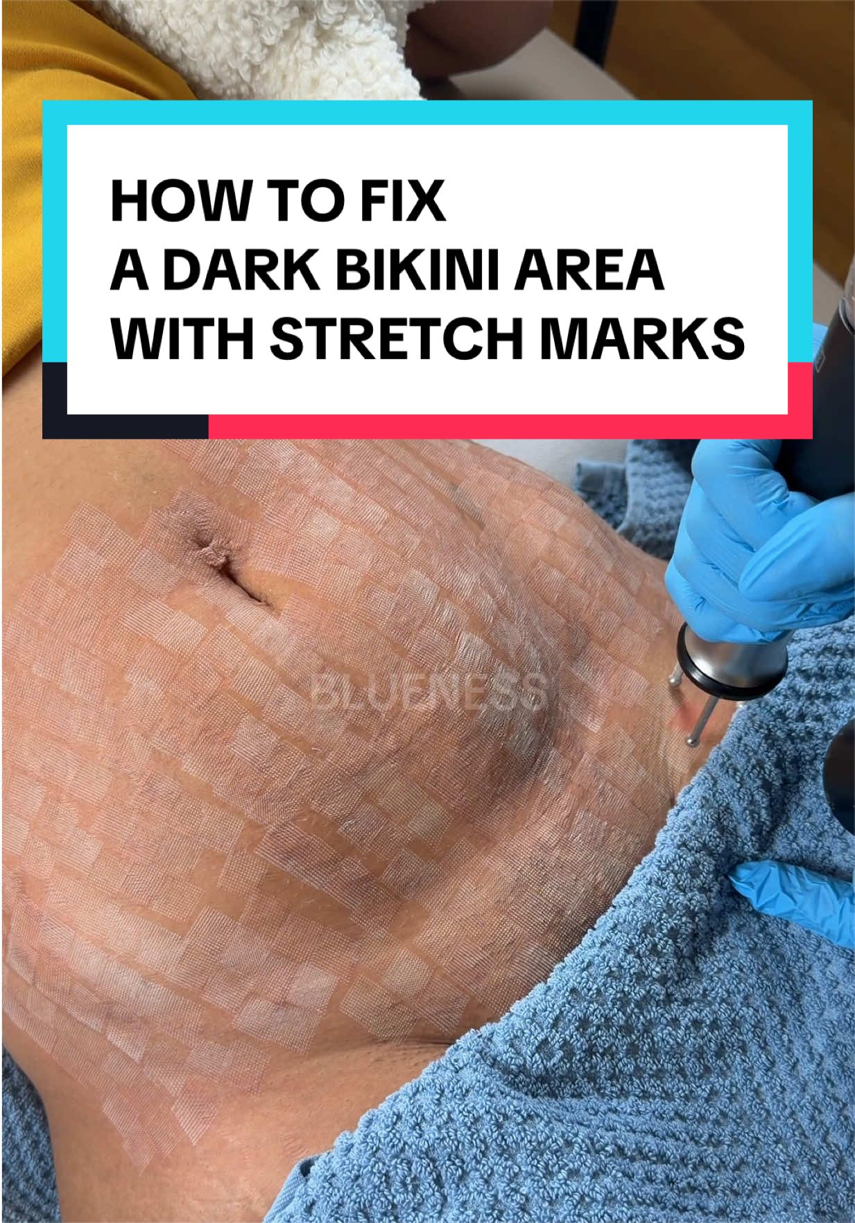 @Blueness by Oceania